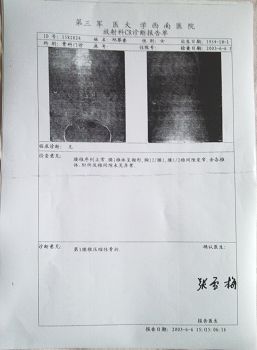 第三军医大学西南医院的诊断书